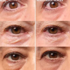 BYE BYE UNDER EYE BAGS