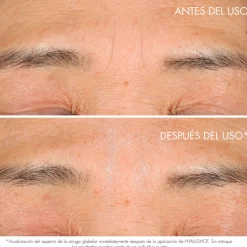 CAPTURE TOTAL HYALUSHOTCorrecteur pour les rides existantes et les premiers signes de rides