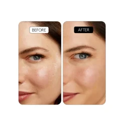 Clinical Retinal 0.1