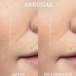 LANCÔME RÉNERGIE H.C.F. TRIPLE SERUM